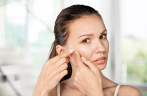 Menopausal Skin - Matsimela
